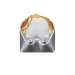 ZomoPlus Customized KITTY Cherry MX Switches And Clones Keycap With CNC Engraving (1u Size) For Mechanical Gaming Keyboard - Silver-0